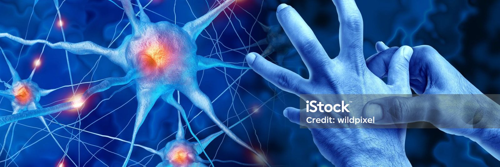 Neurological Disorders