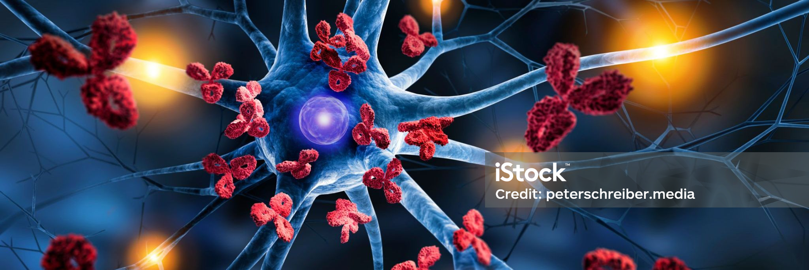 Autoimmune Disorders