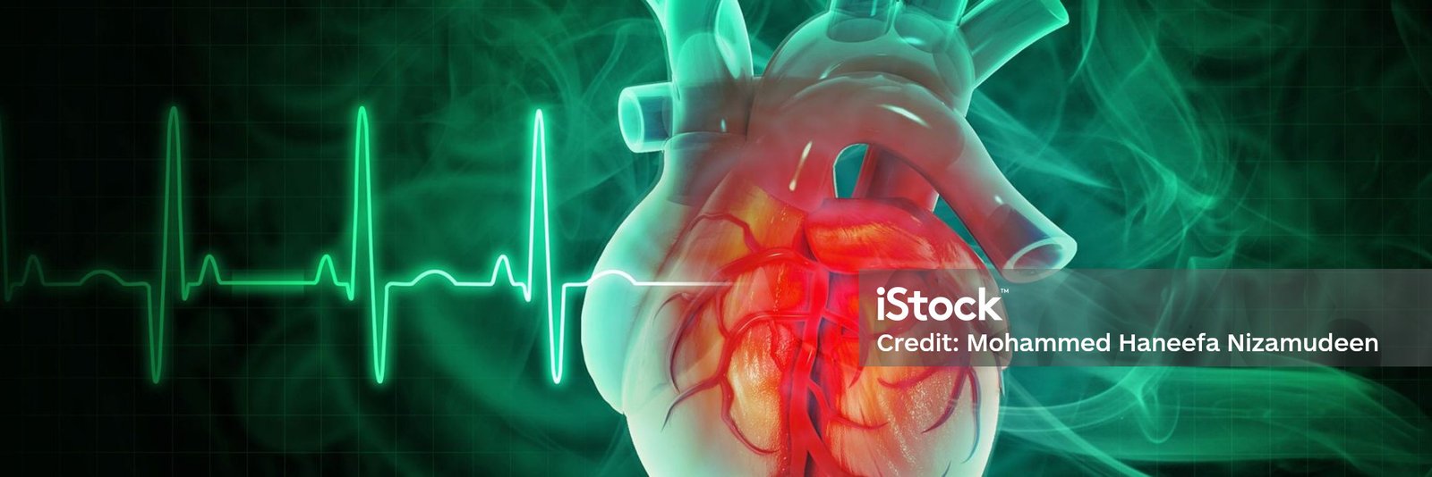Cardiovascular Disease